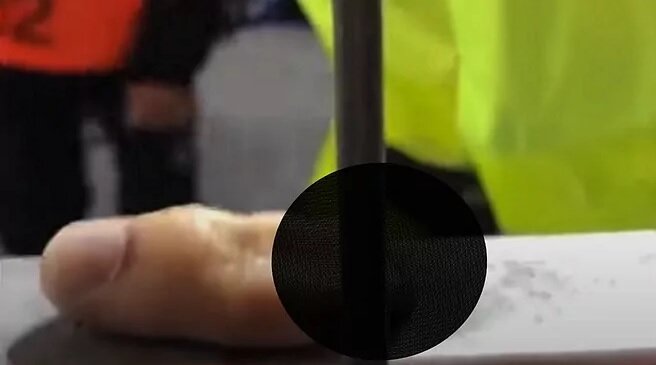 قطع شدن انگشت یک هوادار در لیگ اروپا!/عکس