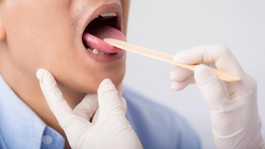 مراقب دهان خود باشید؛ باکتریها به راحتی منتقل میشوند