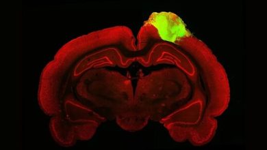 ترمیم مغز آسیب‌دیده موش با سلول‌های آزمایشگاهی مغز انسان