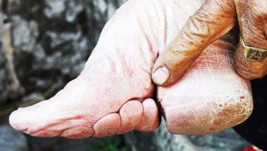 عکس | عجیب ترین سنت دردناک چینی برای تبدیل پاها به کفش!