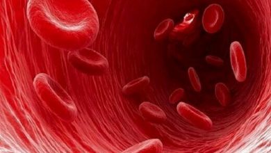 نشانه‌های کم خونی در زنان/ کمبود آهن در بدن چگونه درمان می‌شود؟