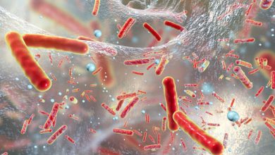 ۵ راهکار طبیعی برای جلوگیری از گسترش عفونت باکتریایی