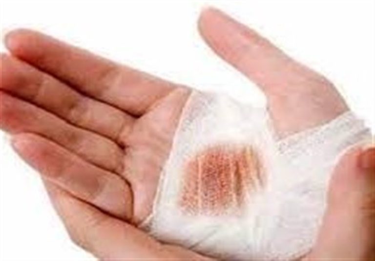 موفقیت پژوهشگران دانشگاه تهران در شناسایی یک هیدروژل برای ترمیم زخمها