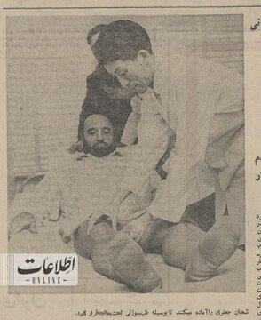 اولین مشتری طبسوزنی در ایران که بود؟/ عکس