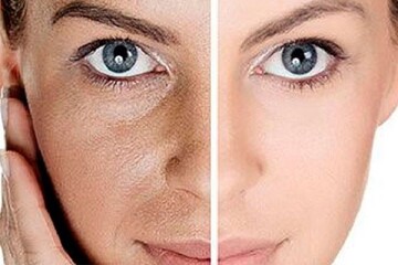 با این خوراکیها از پوست خود محافظت کنید