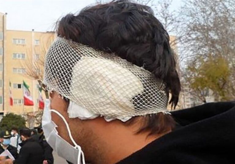 مرد ۵۰ساله با دندان گوش پسر جوان را در نانوایی ابوسعید کند!