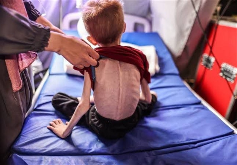 جنگ غزه| از هر ۱۰ کودک، یک کودک در غزه دچار سوءتغذیه است