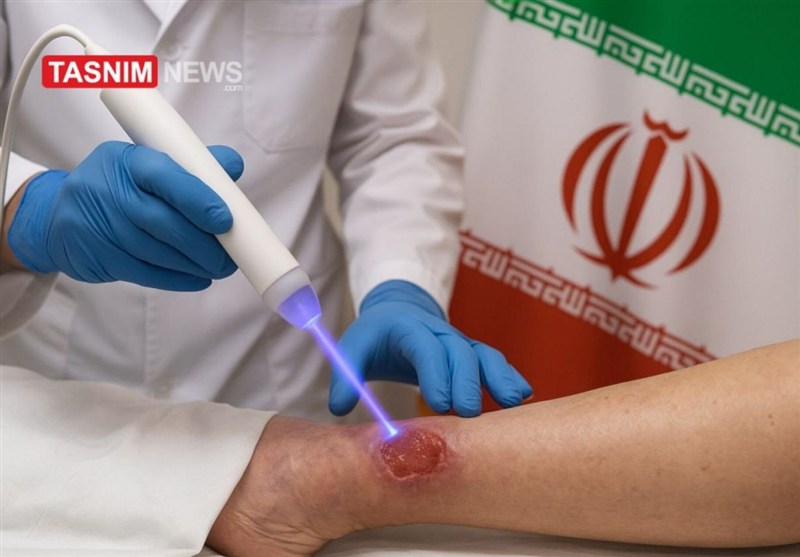 پلاسمای سرد؛ کاربرد انسانی و صلحآمیز صنعت هستهای ایران