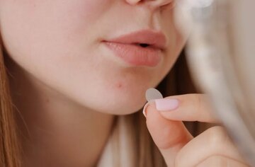 اختراعی برای درمان آکنه در ۷ روز