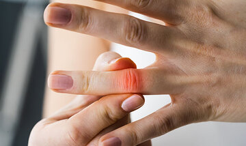 درد مفاصل؟ شاید بدن شما فقط این ویتامینها را کم دارد