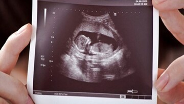 سهم حدود ۱۰ میلیونی بیمار نابارور در برخی نسخه‌ها/ بیمه‌های تکمیلی از مکمل‌های درمان ناباروری در خراسان شمالی حمایت کنند