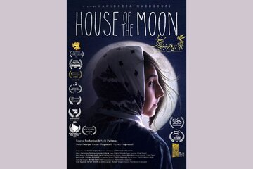 شیلان، دختربچه‌ای که با نقص مادرزادی روی صورتش به دنیا آمده است