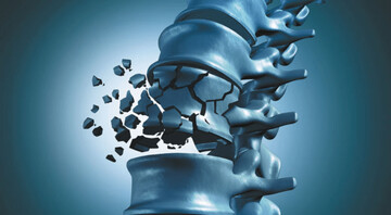 میوهای که استخوانهایتان را از پوک شدن نجات میدهد