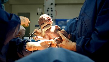 پنج قلوهای کرمانی متولد شدند