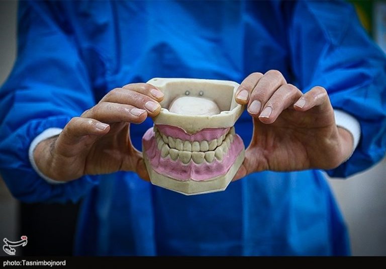 پوشش بیمهای خدمات دندانسازی کامل نیست/ هشدار درباره دندانسازیهای غیرمجاز