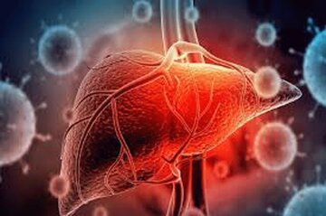 کاهش خطر ابتلا به کبد چرب با مصرف این مواد غذایی