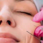 هشدار درباره مصرف ژل‌های تزریقی زیبایی