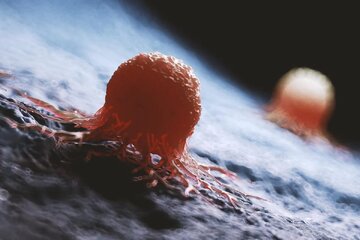 غذاهایی که خطر ابتلا به سرطان را افزایش میدهند