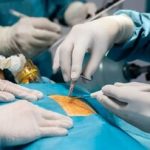 فریب لاغری با بستن رگ اشتها را نخورید؛ این افراد باید با اسلیو و بایپس خداحافظی کنند