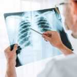 چرا آنفلوآنزا گاهی کشنده می‌شود؟