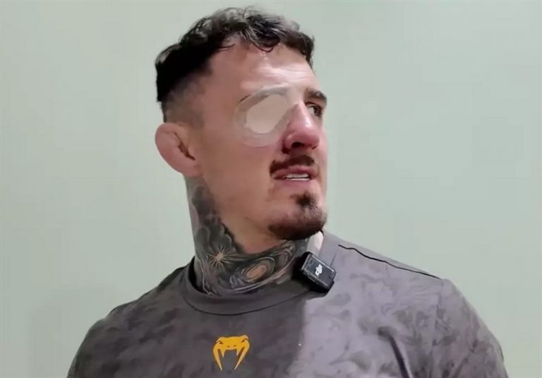 آیا آینده تام آسپینال در خطر است؟