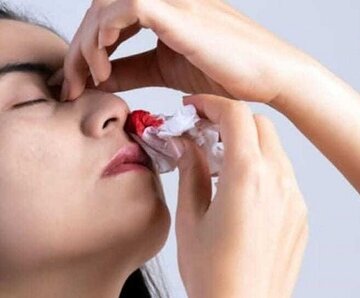 ذخیره اورژانسی داروی فاکتور ۱۳ به صفر رسید