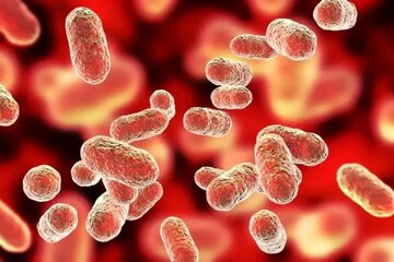 سن ابتلا به کدام سرطانها در ایران در حال کاهش است