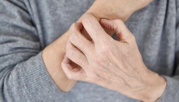 این نشانهها یعنی بیماری پوستی