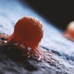 واقعیت کمتر گفته شده درباره سرطان