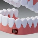 پایان معاینه صرف بصری؟ فناوری جدید برای رصد زودهنگام بیماری لثه