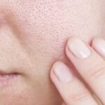 هشدار متخصصان درباره ترندهای وایرال مراقبت از پوست؛ این ۵ روش خانگی را فراموش کنید
